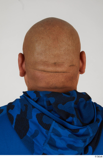 Photos Ernesto Lacasa bald head 0004.jpg